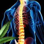 marihuana leczy urazy kregoslupa