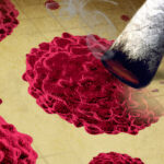 rak piersi a medyczna marihuana