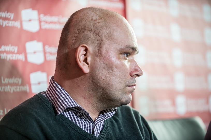 0005TWYNUDDPF34E-C122-F4