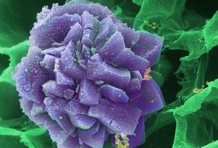 kryształ szczawianu wapnia pod mikroskopem