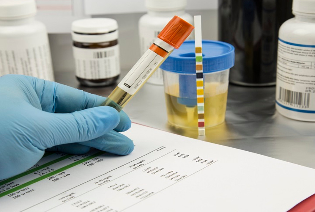 Olej CBD a test narkotykowy